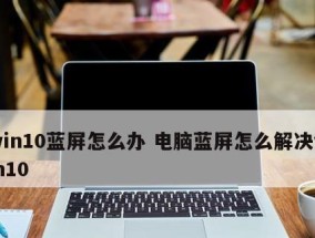 解决电脑蓝屏问题的实用指南（手把手教你轻松应对电脑蓝屏）